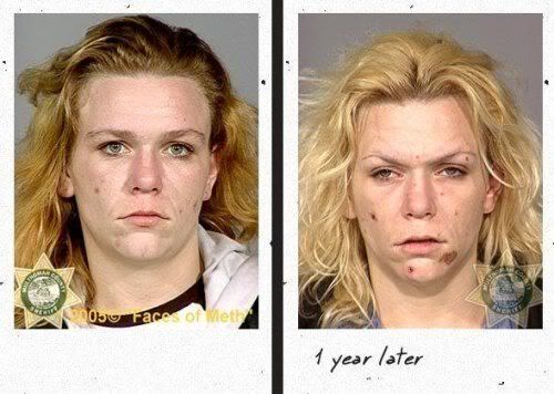 Before and After DRUGS Crazy Pictures