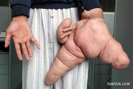 People with 10 Most Extreme Body Parts