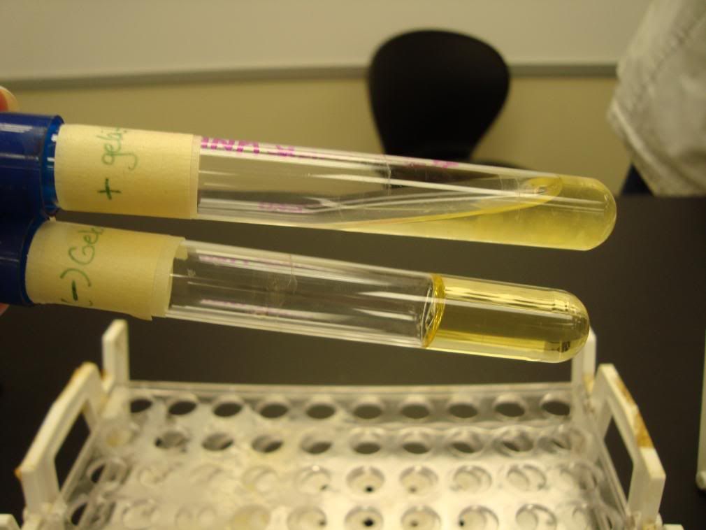 Gelatinase Test Pictures, Images & Photos Photobucket